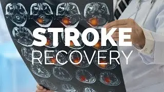 Stroke Recovery | Tips for Dental Hygiene Home Care | Health Advice