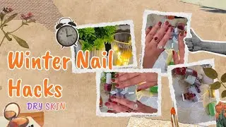 Dry Nails in Winter? ❄️ Try These Easy Nail Care Hacks | Corporate Girl Self Care Vlog