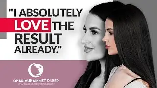 Georgia's Rhinoplasty journey with Dr. Muhammet Dilber