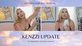 Kenzzi IPL Hair Removal Update