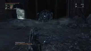 That was shockingly Easy|Darkbeast Paarl|Bloodborne