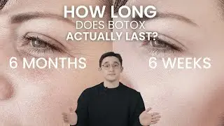 How Long Does Botox Really Last? Everything You Need to Know