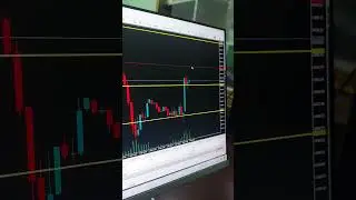 Live Trade Nas100 Simple Strategy #nas100 #analysis #trading #tips