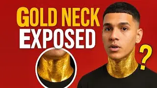 MC Mateo Gold Neck Exposed &ndash; Real Gold Implant or Viral Illusion?