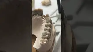Full teeth anatomy !