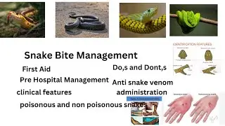 snake bite management, First aid , emergency treatment , management in hospital , dos and don'ts