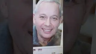 Видео-отзыв: До и После после операции All on 4. Имплантация зубов под ключ за один день
