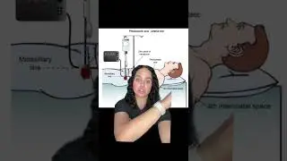 ПОЧЕМУ НУЖНО НАСТРОИТЬСЯ НА ФЛЕБОСТАТИЧЕСКУЮ ОСЬ #icu #icunurses #icurn #newgradnurse #rt