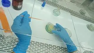 Dectection V.cholera. Day 3. Nutrient agar. Positive