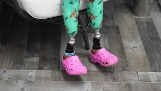 STEP BY STEP: One Jackson girl's journey after limb-loss