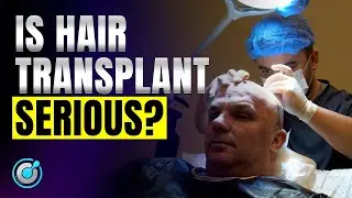 Hair Transplants are not easy: this is what you have to know | BlueMagic Group