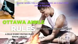 Ankle Injury? Don’t Guess – Master Ottawa Ankle Rules Like a Pro Physio! Simplified (with demo)