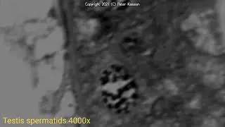 First light microscope with MultiScope technology with the magnification of TEM.