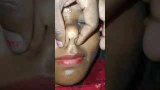 pinching bhavi nose