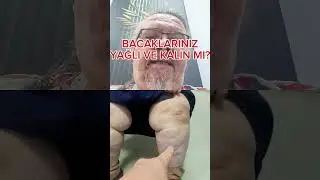 Bacaklarınız YAĞLI VE KALIN MI?