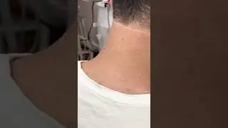 Dauerhafte Haarentfernung - So werden Sie l&auml;stige H&auml;rchen los