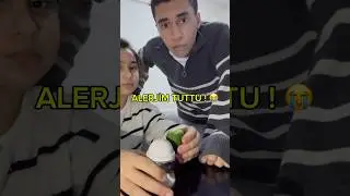 ALERJİM TUTTU !