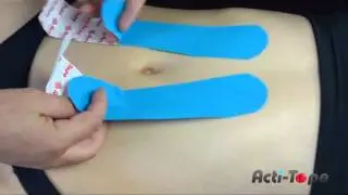 Acti-Tape - Abdominal Support