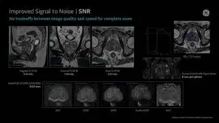 GE Healthcare Prostate MR Commercial