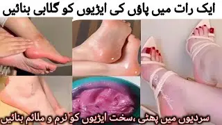 Get Natural Pink Heels Overnight With Just Vaseline!