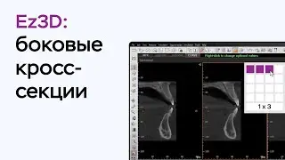Возможности программы Ez3D: боковые кросс-секции