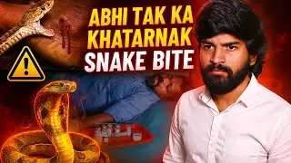 अभी तक का सबसे खतरनाक स्नेक बाइट 🐍 | #muraliwalehausla 