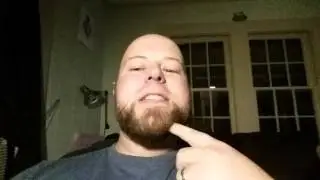 Chin hiccups part 2.