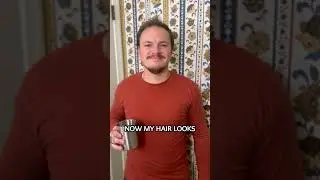 5 Month Hair Growth Results With Locklab - Healthcare Worker's Review