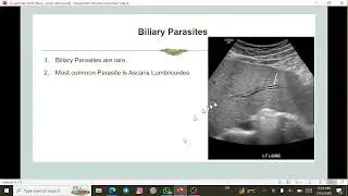 جلسه یازدهم   Caroli Disease - Courvoisier Gallbladder - Mirizzi Syndrome -Choledochal Cysts