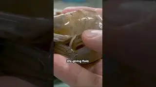 Shrimp Anatomy: Heart in the Head!