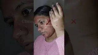 STOP ❌ before using chemical peel solution! 😳