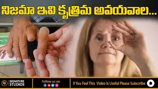 Silicone Finger l Artificial Finger l Cosmetic Restoration l Silicone Prosthesis | Signature Studios