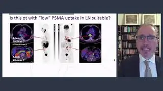 Do we need the second PET (FDG) for patient selection? (including SUV for selection of PSMA therapy)