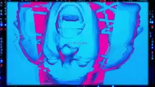 Scaglia - Quando Hai Deciso Di Uccidermi (Prod. Scaglia)