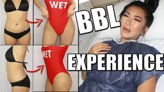 BRAZILIAN BUTT LIFT (BBL) SURGERY EXPERIENCE VLOG | ELITE AFTERCARE