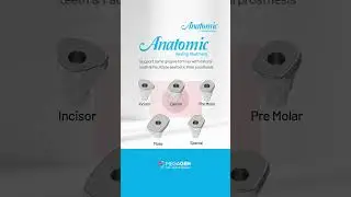 𝐀𝐧𝐚𝐭𝐨𝐦𝐢𝐜 𝐇𝐞𝐚𝐥𝐢𝐧𝐠 𝐀𝐛𝐮𝐭𝐦𝐞𝐧𝐭 - Aesthetic final prosthesis, like natural teeth