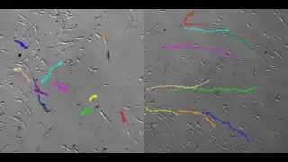Time Lapse Photography of  Stem Cells: Cell Motility on Plastic Vs StemBioSys CELLvo&trade; Matrix