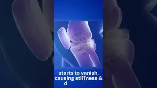 Best Joint Pain Relief in USA &ndash; Move Freely Again #jointpainrelief #jointgenesis #shorts #arthritis