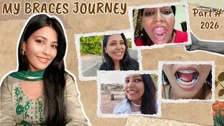🦷😨 My Braces Journey ll Watch This Before Getting Braces 2026 l My Honest Review #braces 