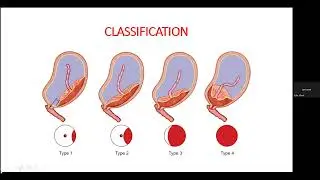 midwifery class 6 loksewa preparation