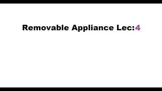 Lec:4 Removable Appliance : Different types of Clasp.