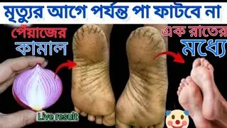 ১ রাতেই পা ফাটা সারানোর টিপস / Cracked heels treatment