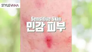 Your Solution for Skin Prone to Large Pores | NATUREKIND | Stylevana K-Beauty & K-Fashion