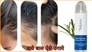 कम उम्र में बाल क्यू झड़ते हैं |  नाये बाल कैसे उगाये | Bodywise hair growth serum review 