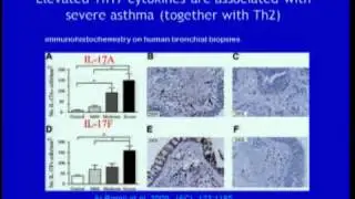 The Asthma Epidemic - Marsha Wills-Karp, PhD