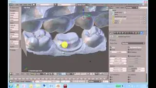 Virtual Articulator physics