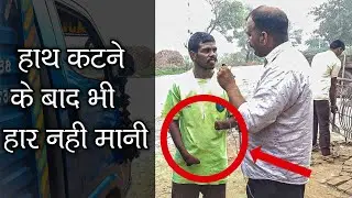 दोनों हाथ कटने के बाद भी हार नही मानी | HR 16 DHAMAKA NEWS
