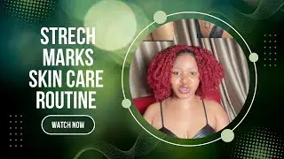 BEST BODY LOTION TO USE WHEN YOU GAT STRETCH MARK