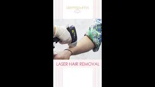 Derma Puritys | Laser Hair Reduction