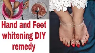  Remove Tan & Dead Skin from Feet | Natural Foot Care Routine#feetcare #skincareroutine #skinwhiteni